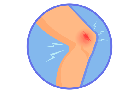 Knee Injury Wound Medical Leg Pain Illu